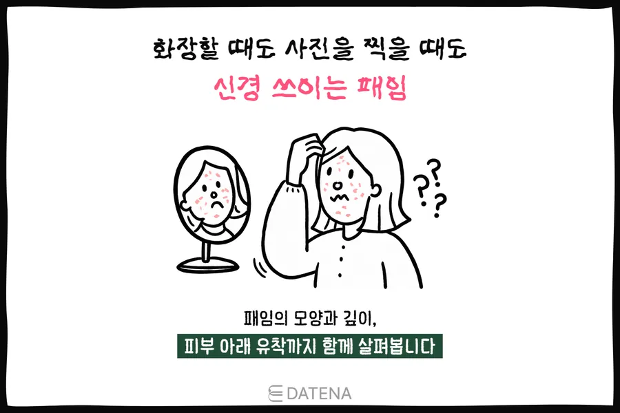 看著鏡中臉頰凹陷痘疤的女性，以及表現化妝、拍照時在意凹陷的插圖