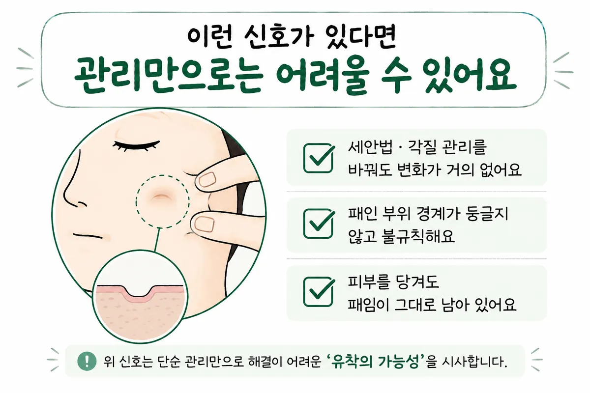 洗臉與去角質後仍殘留的凹陷、不規則邊界、拉開皮膚仍存在的凹凸檢查示意圖