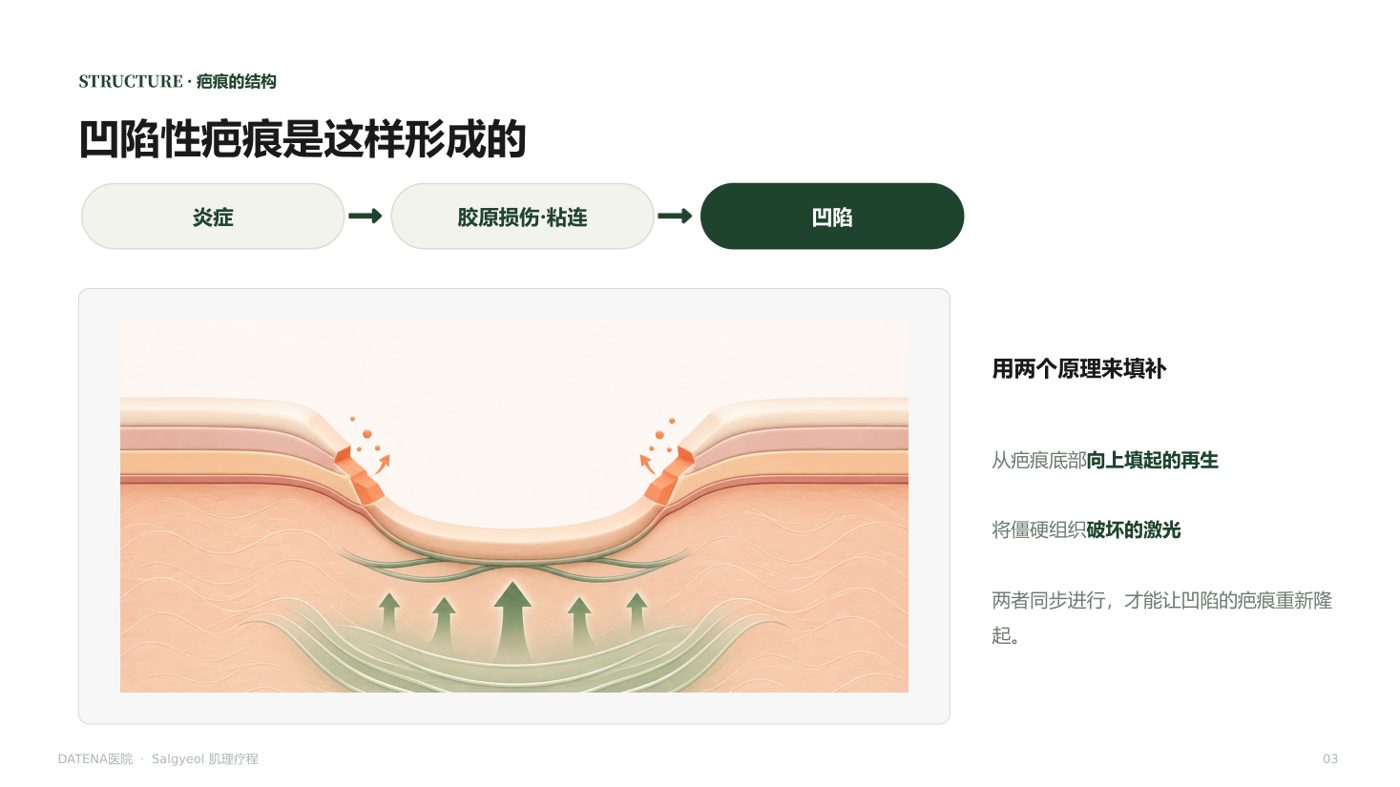 痘坑治療項目說明資料 3/14