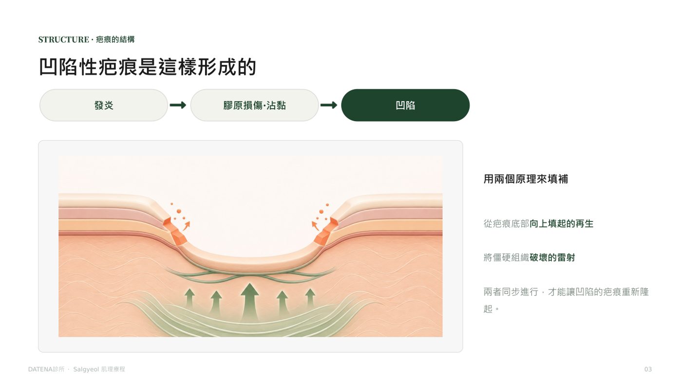 肌理再生療法 諮詢資料3